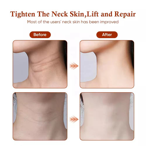 Face and Neck Lifter